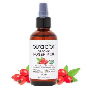 PURA D’OR 4 Oz ORGANIC Rosehip Seed Oil – 100% Pure Cold Pressed USDA Certified Anti-Aging Treatment – Vitamin A & C Rich – Helps Fade Appearance of Scars & Stretch Marks – For Face, Hair & Body(4 Fl Oz (Pack of 1))